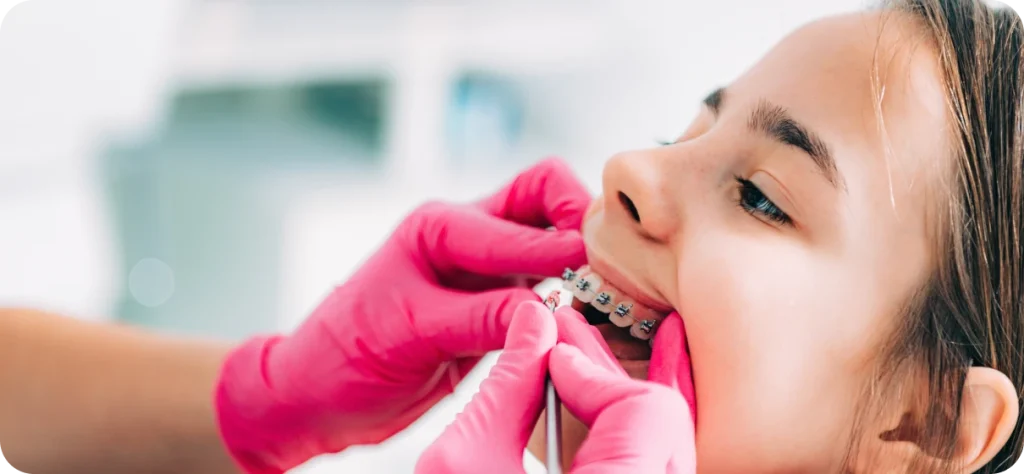 Élastiques intermaxillaires