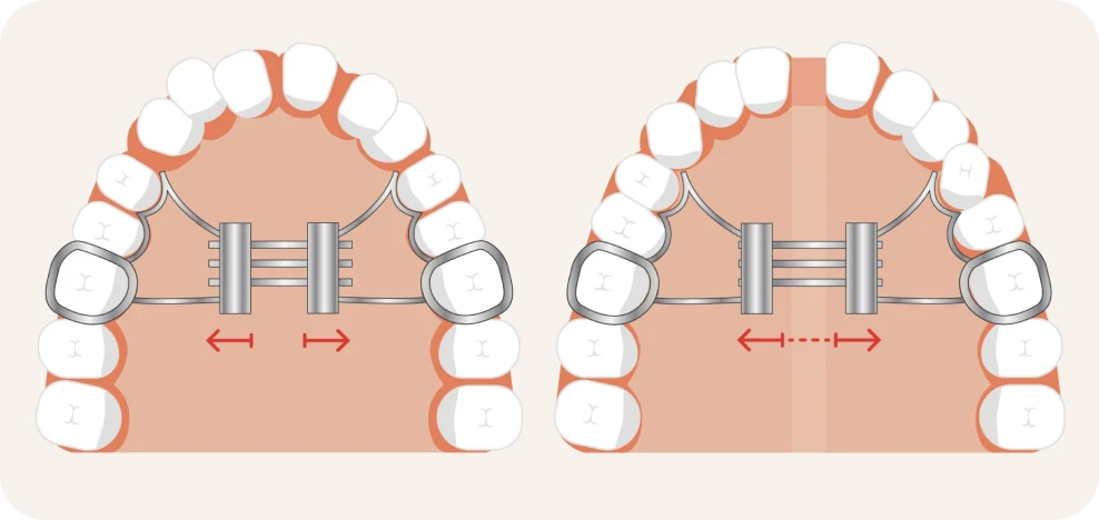 fonctionnement disjoncteur cabinet docteurs davy alam