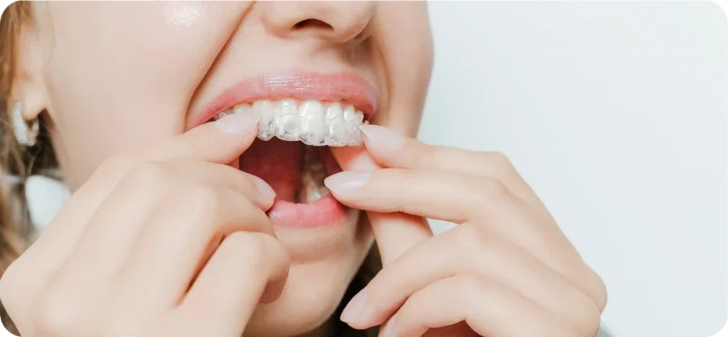 Pourquoi la contention est importante ?